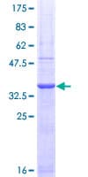 Human PAD2 / PADI2 Protein (Recombinant GST, N-terminus)