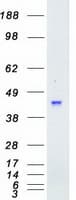 Human MAPKAPK3 Protein (Recombinant Myc-DDK (Flag))