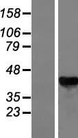 GALK1 / GK1 Protein (Over-Expression Lysate Myc-DDK (Flag))