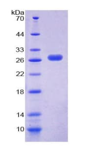 Mouse CXCL16 Protein (Recombinant His-T7)