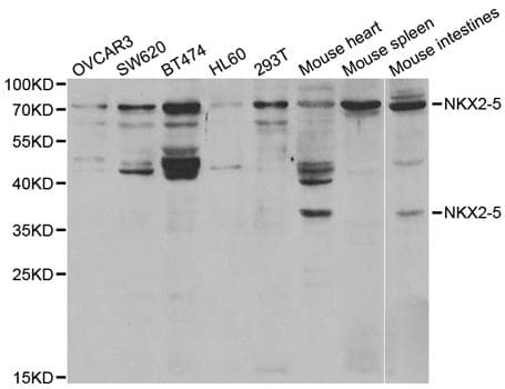 Polyclonal Rabbit anti-Human NKX2-5 Antibody (WB)
