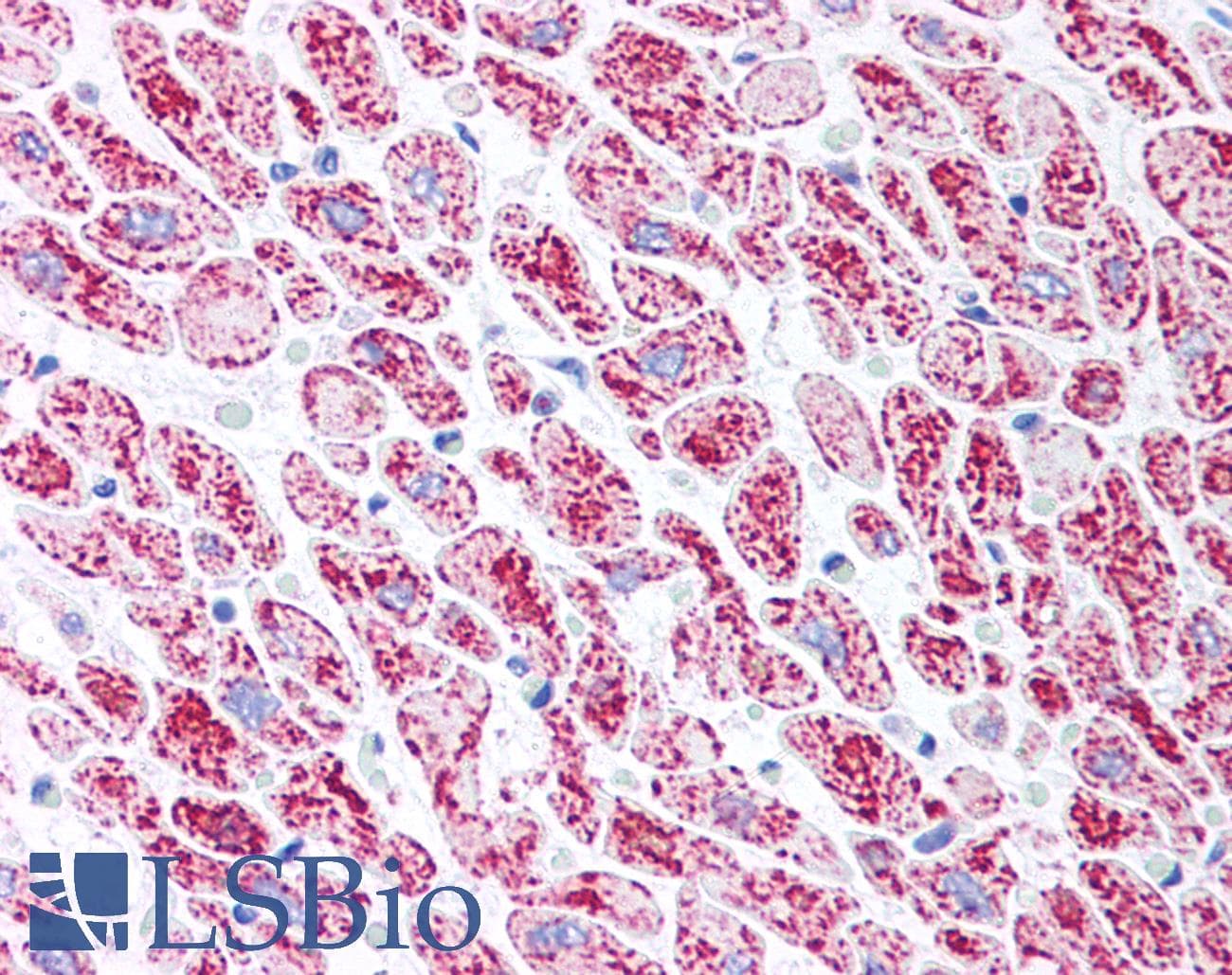 IHC-plus™ IMMT / Mitofilin Antibody
