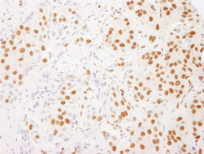 RALY Antibody (aa150-200)