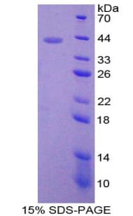 Rat MMP10 Protein (Recombinant His-T7)