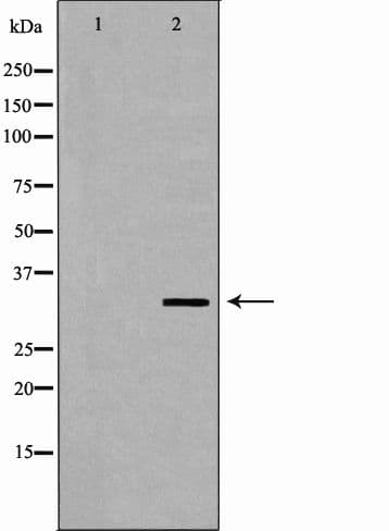 AZGP1 / ZAG Antibody
