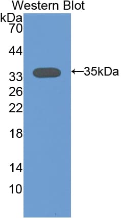 PRKCA / PKC-Alpha Antibody (aa339-597, HRP)
