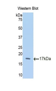 ACE2 / ACE-2 Antibody (aa334-409, PE)