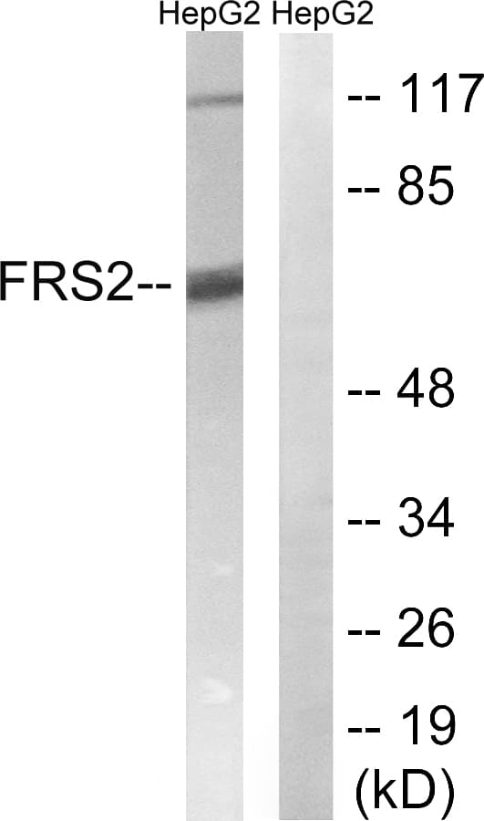 FRS2 Antibody (aa162-211)