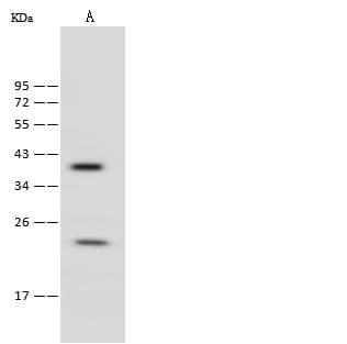 Polyclonal Rabbit anti-Mouse RAB9A / RAB9 Antibody (WB)