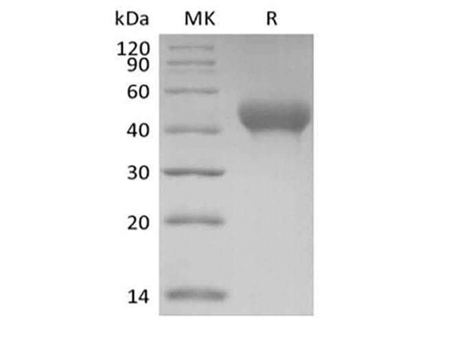 Mouse GP6 / GPVI Protein (Recombinant 6His, C-terminus)