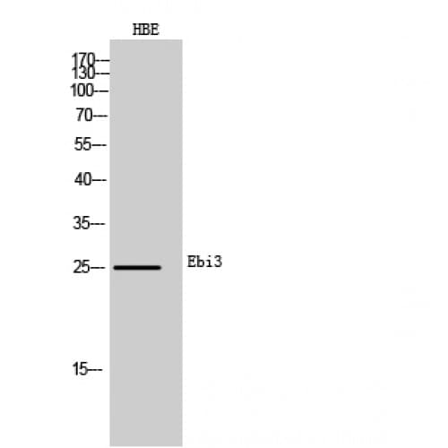EBI3 / IL-27B Antibody (101-150 aa, Internal)