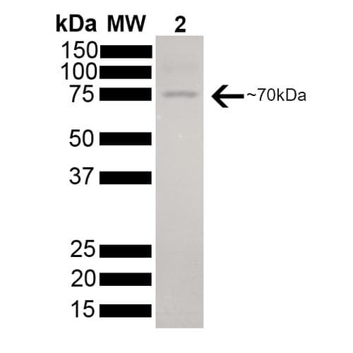 Human HSPA8 / HSC70 Protein (Recombinant His)