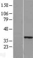 HOXA11 Protein (Over-Expression Lysate Myc-DDK (Flag))