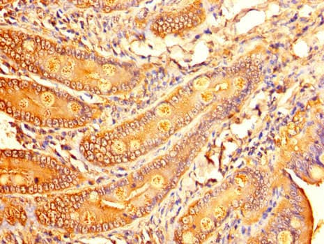 Polyclonal Rabbit anti-Human ALDOC / Aldolase C Antibody (IHC, IF, WB)