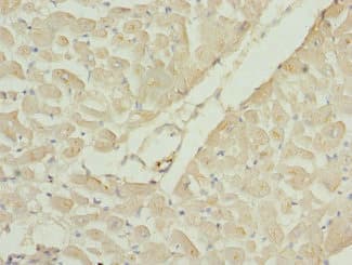 RAC3 Antibody