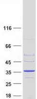 Human DHRS9 Protein (Recombinant Myc-DDK (Flag))