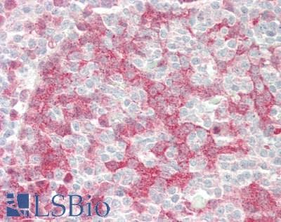 IHC-plus™ YWHAE / 14-3-3 Epsilon Antibody