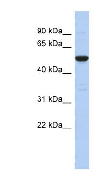 Taperin / TPRN Antibody (C-Terminus)