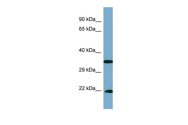 SLC6A6 / Taurine Transporter Antibody (aa197-246)