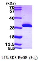 Human BDH2 Protein (Recombinant His)
