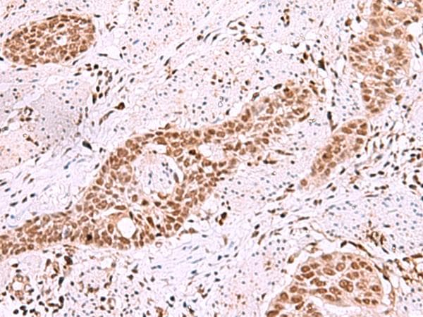 Polyclonal Rabbit anti-Human ISL2 / Islet 2 Antibody (IHC)