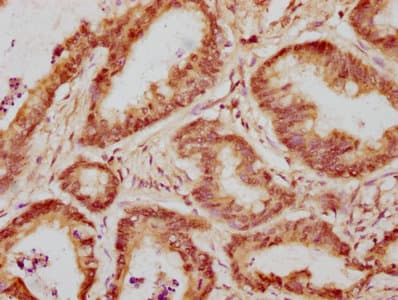 Polyclonal Rabbit anti-Human WAPAL / WAPL Antibody