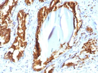 ACPP / PAP Antibody (clone rACPP/1338, Azide-free, Carrier-free)