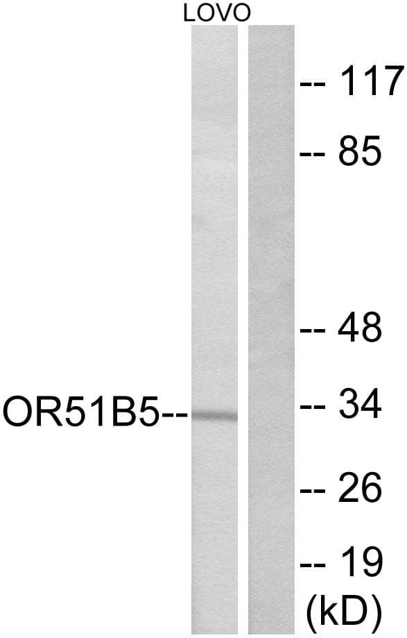 OR51B5 Antibody