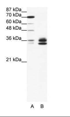 Polyclonal Rabbit anti-Human RELA / NFKB p65 Antibody (aa21-70, WB)