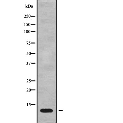 Polyclonal Rabbit anti-Human MT-ATP8 Antibody (WB)