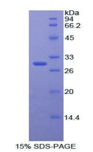 Rat CTNNB1 / Beta Catenin Protein (Recombinant His)