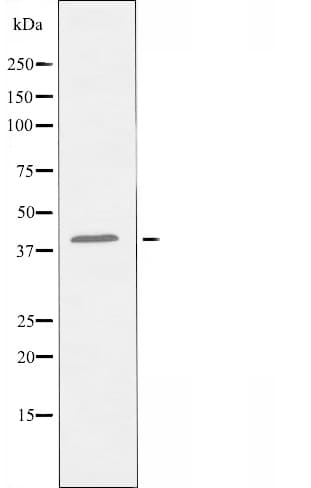 Polyclonal Rabbit anti-Human PTGER2 / EP2 Antibody (WB)