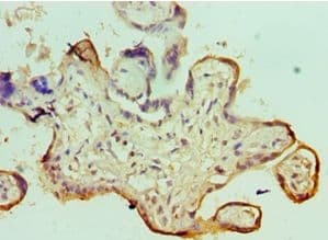 SMARCC1 / SWI3 Antibody (aa80-320)