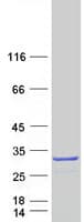 Human SENP8 Protein (Recombinant Myc-DDK (Flag))