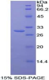 Human TAB1 Protein (Recombinant His, N-Terminal)