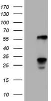 TCP11L2 Antibody (clone OTI2H4)