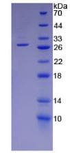 Mouse PRSS2 / Trypsin 2 Protein (Recombinant 6His, N-terminus)