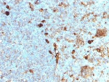 SERPINA1 / Alpha 1 Antitrypsin Antibody (clone AAT/1378)