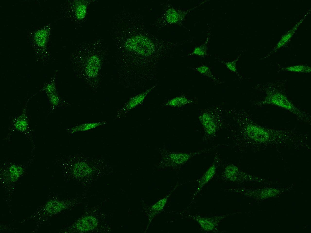 MBD5 Antibody (Preservative Free)