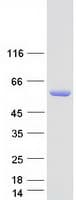 Human IRF5 Protein (Recombinant Myc-DDK (Flag))