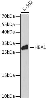 HBA2 / Hemoglobin Alpha 2 Antibody
