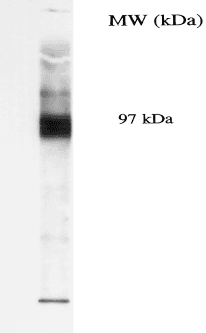 Monoclonal Mouse anti-Human SLC5A5 / NIS Antibody (clone 14F, aa625-643, IHC, WB)