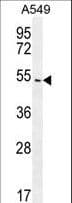 Polyclonal Rabbit anti-Human ARRB1 / Beta Arrestin 1 Antibody (aa336-363, IHC, IF, WB)