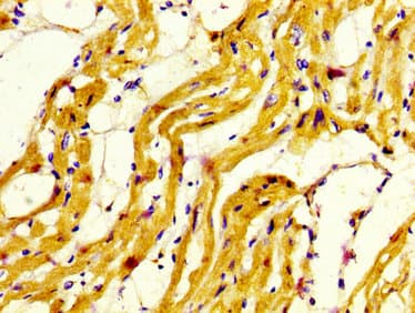 MYH7 Antibody