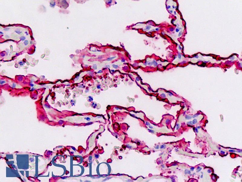 IHC-plus™ EMA / MUC1 Antibody (clone M4H2)