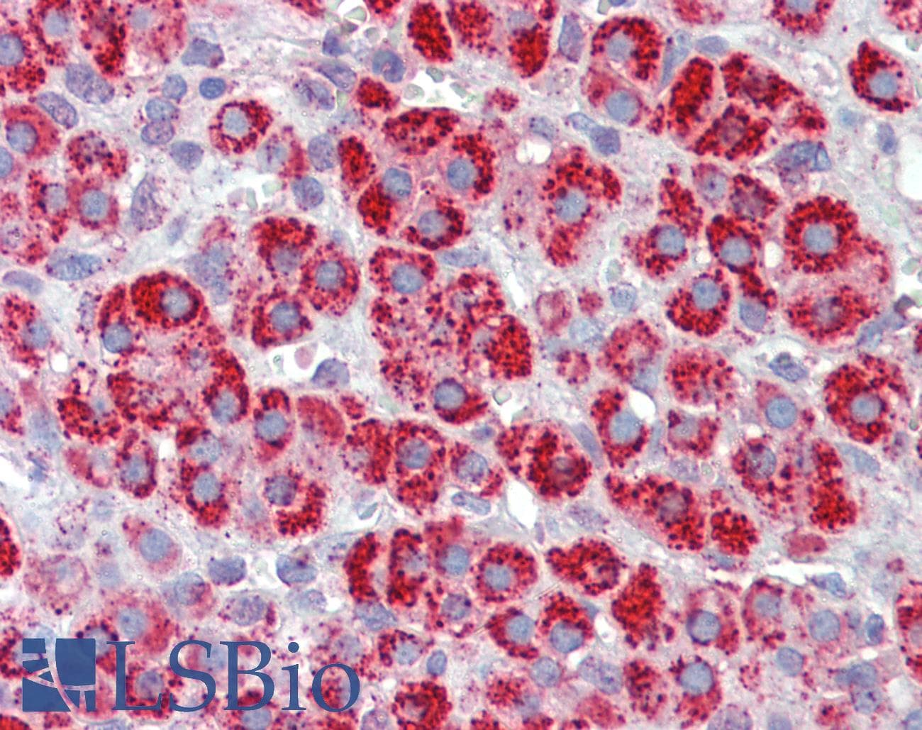 PathPlus™ Polyclonal Goat anti-Human HSPD1 / HSP60 Antibody (IHC, WB)