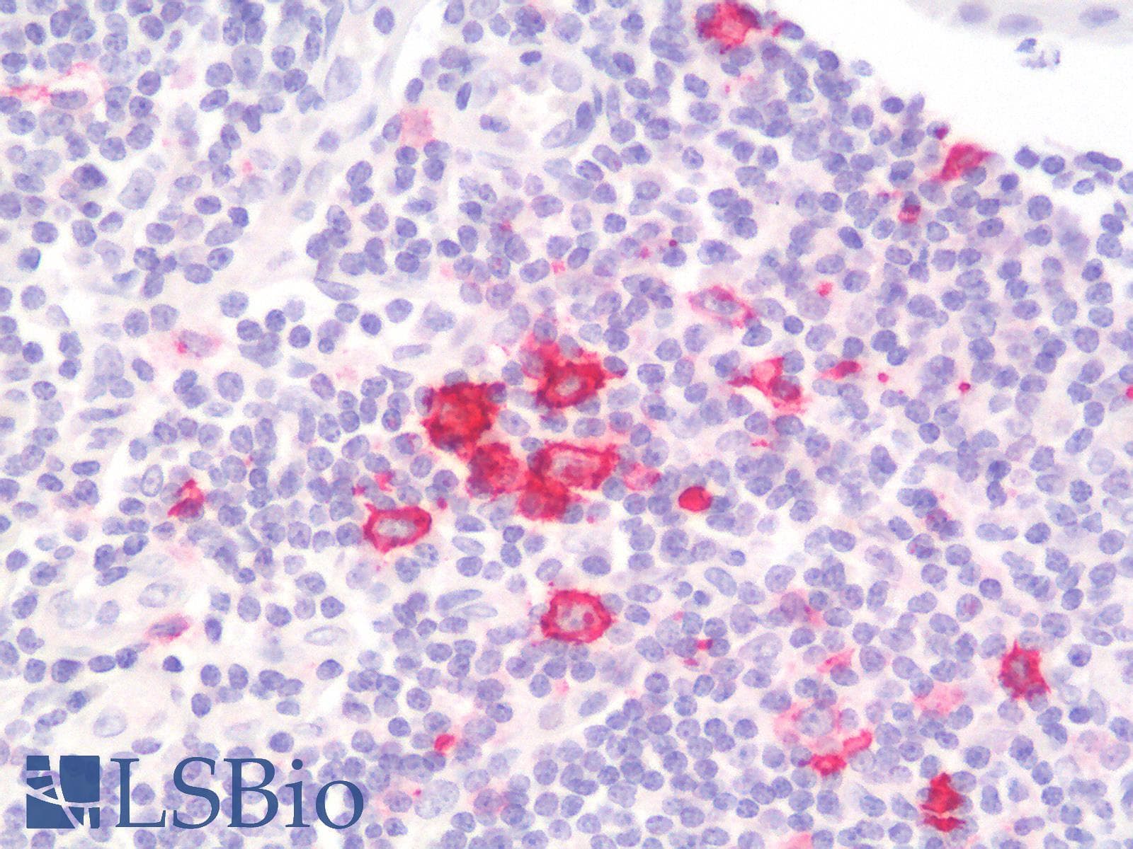 PathPlus™ Recombinant Monoclonal Mouse anti-Human CD30 Antibody (clone rKi-1/779, IHC)
