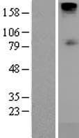 SLC5A1 / SGLT1 Protein (Over-Expression Lysate Myc-DDK (Flag))