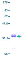 Human PCP4 / PEP19 Protein (Recombinant GST)
