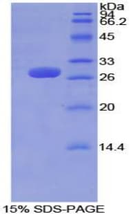 Mouse TUBD1 / Tubulin Delta Protein (Recombinant His-T7)